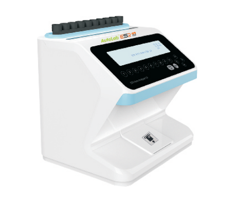 ESR analyzer